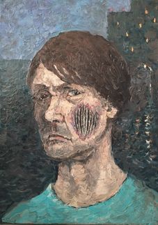Человек с неизвестным заболеванием на лице